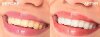 feature-teeth-lips.jpg